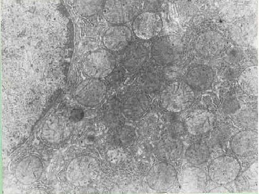 fig. 2 - Hepatocito de rata tratada con ozono. Se observa ncleo, retculo endoplasmitco rugoso y mitocondrias con caractersticas similares a los controles 15 000X